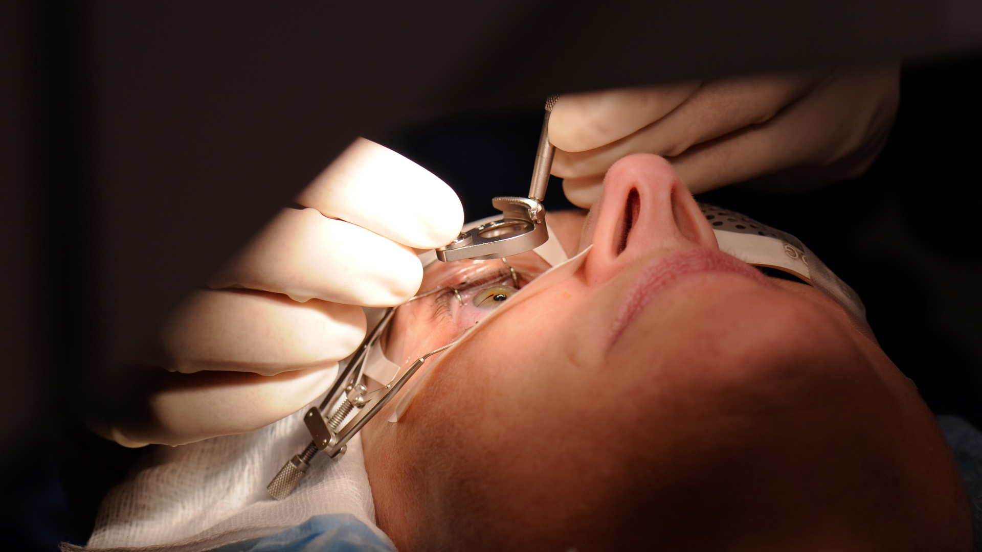 Cornea Surgeries cost